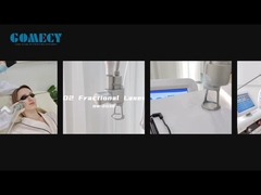 Fractieve CO2 laser huidverjonging huid strakker maken