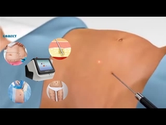 Laser Lipo-apparatuur 30W 60W 980nm Diode Lipo-lasermachine voor gewichtsverlies