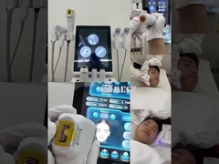 12d hifu + vmax + M8 + ICE HAMMER 4 IN 1